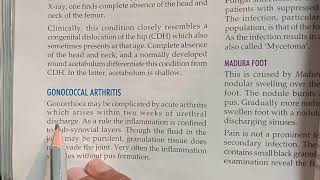 Gonococcal Arthritis [upl. by Larimer]