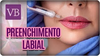 Preenchimento Labial  Você Bonita 281117 [upl. by Ydnak517]