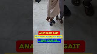 Antalgic gait video of patient  analysis example  description and pattern of Gait gait [upl. by Whall]