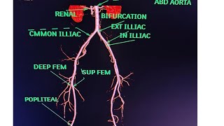 CT Lower Limb Angiography Anatomy CT scanPost processing avnishradiologypart1 [upl. by Desdamona]