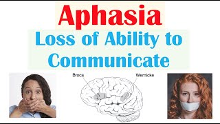 Aphasia  Types Broca’s Wernicke’s Global Causes Signs amp Symptoms Diagnosis Treatment [upl. by Ebaj]