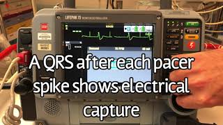 LifePak 15 Transcutaneous Pacing [upl. by Reinar]