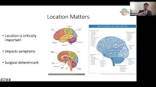 The Glioblastoma Brain Cancer Patient Journey DEMYSTIFIED [upl. by Aday525]