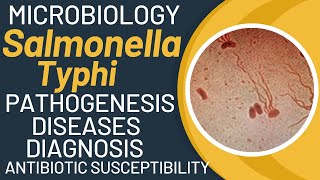 Salmonella typhi microbiology  Typhoid fever pathogenesis by salmonella typhimurium [upl. by Yevad899]