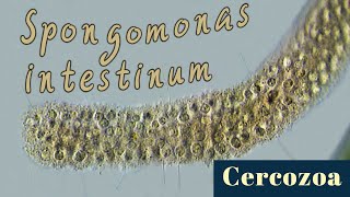 Colonial flagellates Spongomonas intestinum Cercozoa [upl. by Silvester]