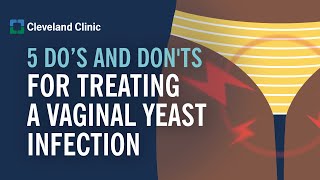 How to Treat a Yeast Infection [upl. by Oznohpla]