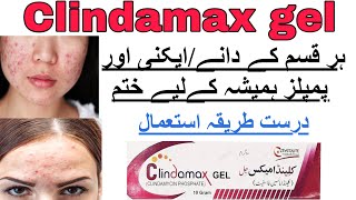 clindamax gel for acne reviews Climdamycin Treatment of acneHow to use clindamax gel side effects [upl. by Aguayo]