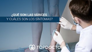 ¿Qué son las Várices y cuáles son los síntomas [upl. by Avonasac]