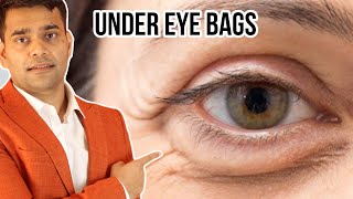 Under Eye Home Remedy  Remove Under Eye Bags Completely  Remove Dark Circle Wrinkles Puffy Eyes [upl. by Bonita]