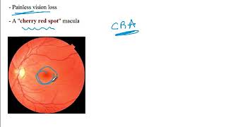 Video 219 Common Refractive Errors amp Retinal Pathologies Clinical Presentations amp Diagnosis [upl. by Ailecra523]