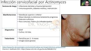 Actinomyces manda sus saludos ENARM [upl. by Mientao]