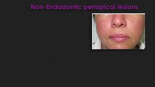 Periapical Neoplastic Lesions Prof Rania Othman [upl. by Lativa]