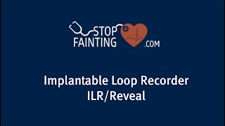 Implantable Loop Recorder [upl. by Aener421]