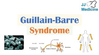 GuillainBarré Syndrome GBS  Causes Pathophysiology Signs amp Symptoms Diagnosis Treatment [upl. by Nerita]