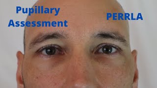 Pupillary Assessment PERRLA [upl. by Yelir]