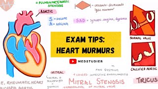 How to remember heart murmurs  Mnemonics Diagrams amp More  MedStudier [upl. by Asilav219]