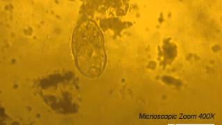 Parasitology Video Balantidium coli in TYIS33 medium  Clip 2 [upl. by Hoxie]