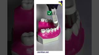 Effective Tooth Brushing Techniquesorthodontics dentist orthodontistbrushing toothpaste brush [upl. by Hancock]