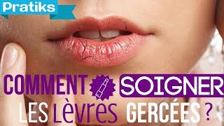 Comment soigner les lèvres gercées [upl. by Eidualc]