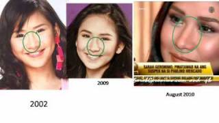 Sarah Geronimo Nose Job [upl. by Adnalram198]