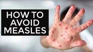 How to avoid measles [upl. by Dunning]