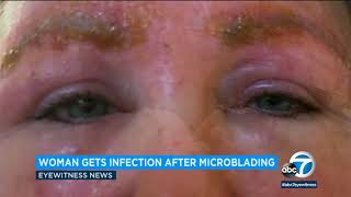 Microblading eyebrows can lead to infection woman warns  ABC7 [upl. by Lotte]