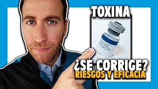 🔵 TOXINA BOTULÍNICA para ESTRABISMOS ¿es efectiva [upl. by Nnadroj]