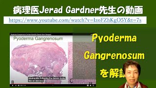 Pyoderma gangrenosumの病理組織像の解説動画 [upl. by Derwin]