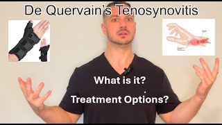 De Quervains Tenosynovitis Patient Education and Treatment [upl. by Pas]