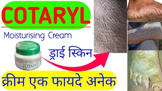 COTARYL Skin Cream Uses  What is Hyperkeratotic skin and Ichthyosis skin and its tretments [upl. by Virgina356]