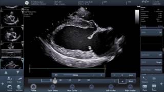 IMV imaging prev BCF Technology Video 3  How to perform basic echocardiographic measurements [upl. by Nelson]