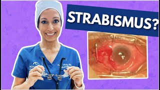 What To Expect With Strabismus Surgery  Eye Surgeon Explains [upl. by Notsla]