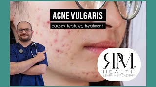 Acne vulgariscausesfeatures and treatment RPM HEALTH LEARNING ACADEMY by rpmhealthclinic [upl. by Fredie]