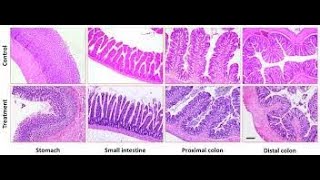 Differences in histology of the Large intestine and Small intestine [upl. by Lorine737]