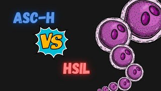 Diferencias entre ASCH y HSIL Citología cervicovaginal [upl. by Eitak]