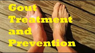 Gout Treatment and Prevention [upl. by Anna-Diana]