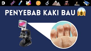 ZOOM MIKROSKOP PENYEBAB BAU KAKI YANG MENYENGAT  DIRGA BIOLOGY CHANNEL [upl. by Anitneuq]