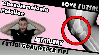 Injury update  Chondromalacia Patella  Runners Knee [upl. by Kayla]