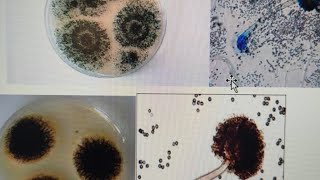 aspergillus  fungus  detailed discussion  microbiology immunology  important  yt video long [upl. by Janey]