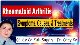 Understanding Rheumatoid Arthritis  Dr Gary Sy [upl. by Lemuela]