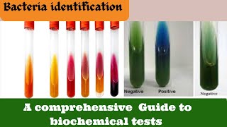 Identify Bacteria FAST with this Biochemical Test Microbiology [upl. by Ykcir]