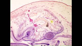 Cancellous spongy bone Pig Embryo snout [upl. by Anabahs610]