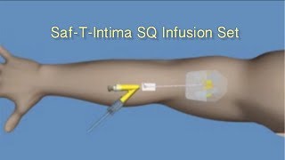 How to Insert SafTIntima™ SQ Infusion Set [upl. by Llebanna214]