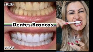 como deixar os DENTES brancos em 2 minutos receita caseira  Nina Della Rosa [upl. by Hankins]