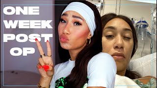 I GOT SURGERY 😳  MyLifeAsEva [upl. by Resarf]