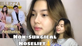 NONSURGICAL NOSE LIFT EXPERIENCE  Belleza Aesthetics [upl. by Llenoj]