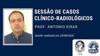 Sessão de Medicina Interna com Prof Antonio Eiras [upl. by Gaylene840]