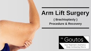 Brachioplasty  Arm Lift Surgery  Procedure and Recovery [upl. by Bonine]