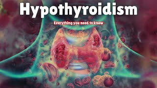 Hypothyroidism  Symptoms Causes Treatment amp Medication [upl. by Ellocin]