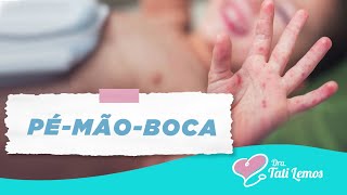 SINDROME MÃOPÉBOCA  Dra Tati Lemos [upl. by Nanis]